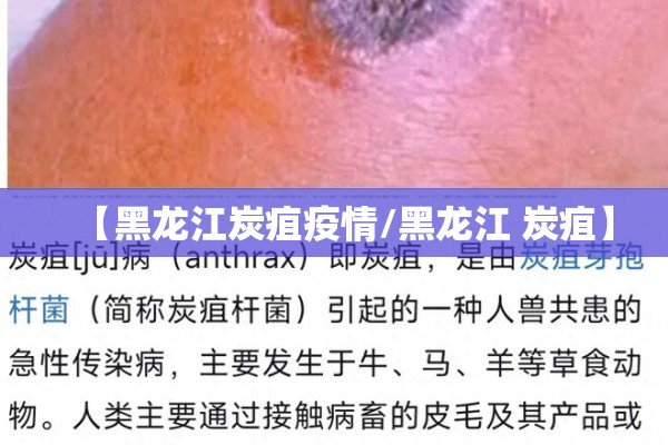 【黑龙江炭疽疫情/黑龙江 炭疽】