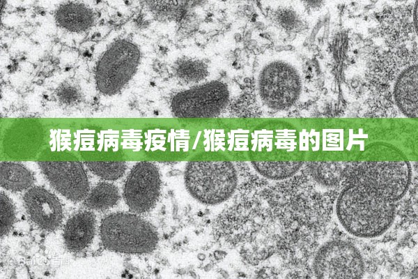猴痘病毒疫情/猴痘病毒的图片