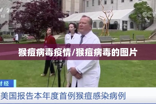 猴痘病毒疫情/猴痘病毒的图片 猴痘病毒疫情/猴痘病毒的图片