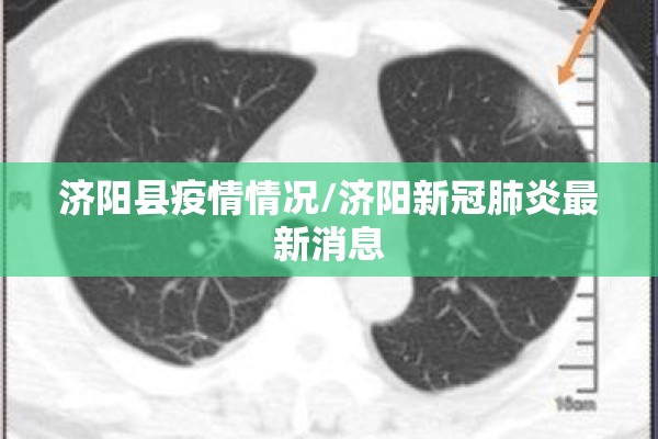 济阳县疫情情况/济阳新冠肺炎最新消息 济阳县疫情情况/济阳新冠肺炎最新消息