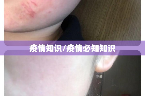 疫情知识/疫情必知知识