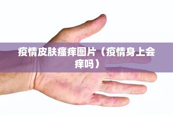 疫情皮肤瘙痒图片（疫情身上会痒吗）